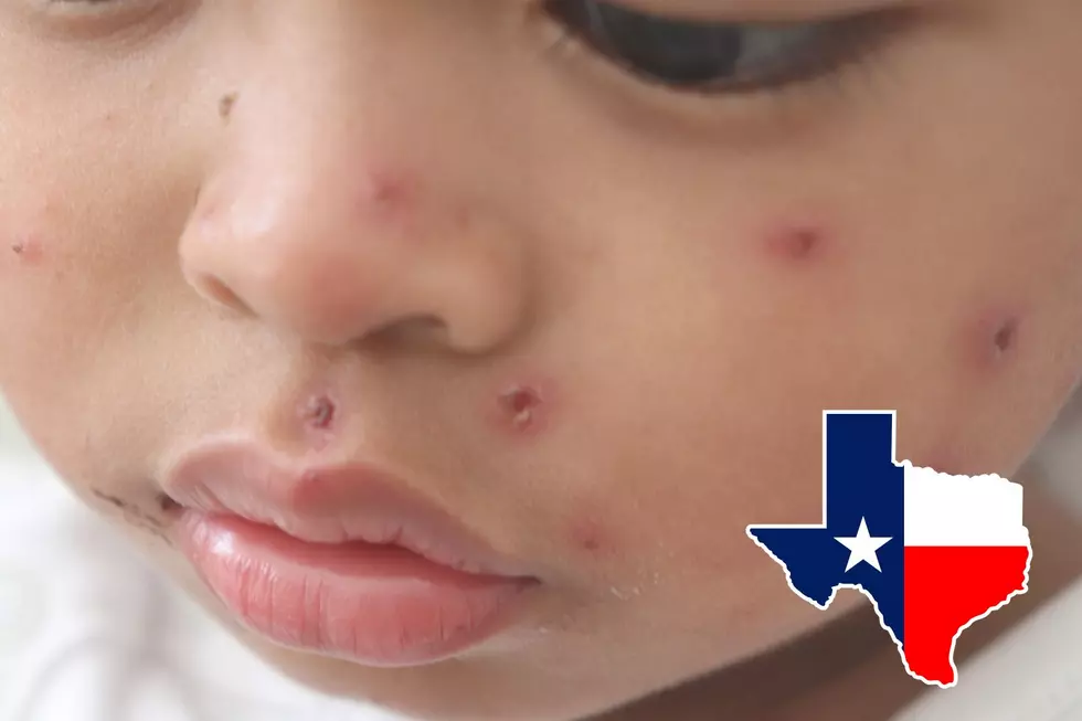 Texas Measles Outbreak Officially Now The Worst In 30 Years